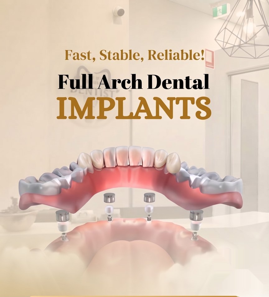Sample dental practice post: Full arch