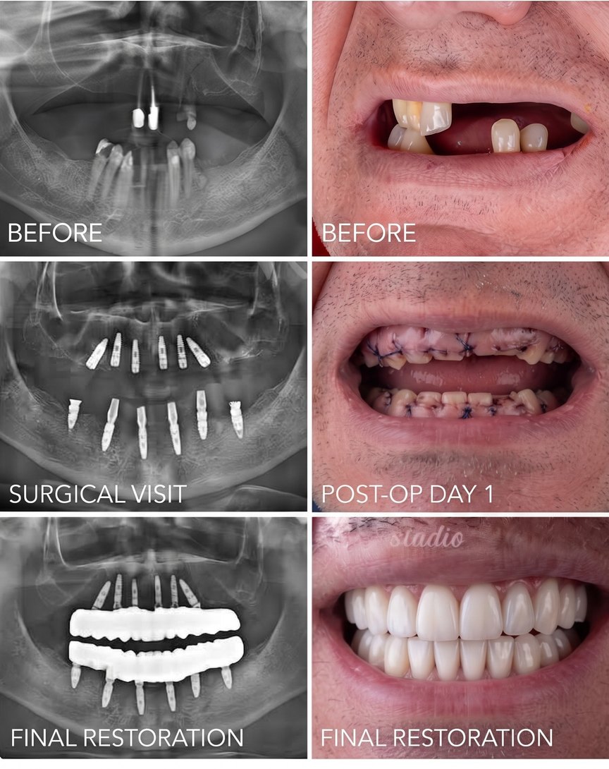 Sample Facebook post: Crowns