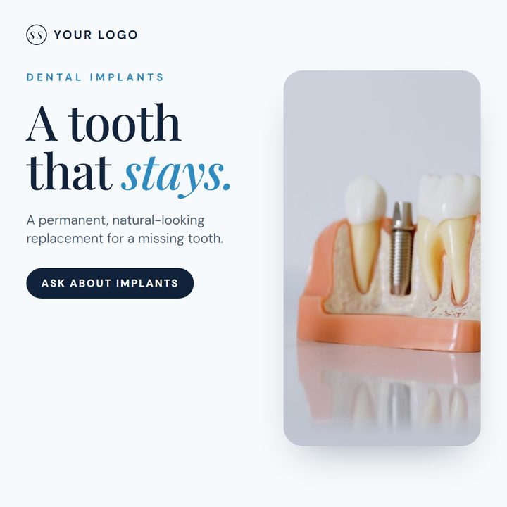 Sample dental practice post: Implants