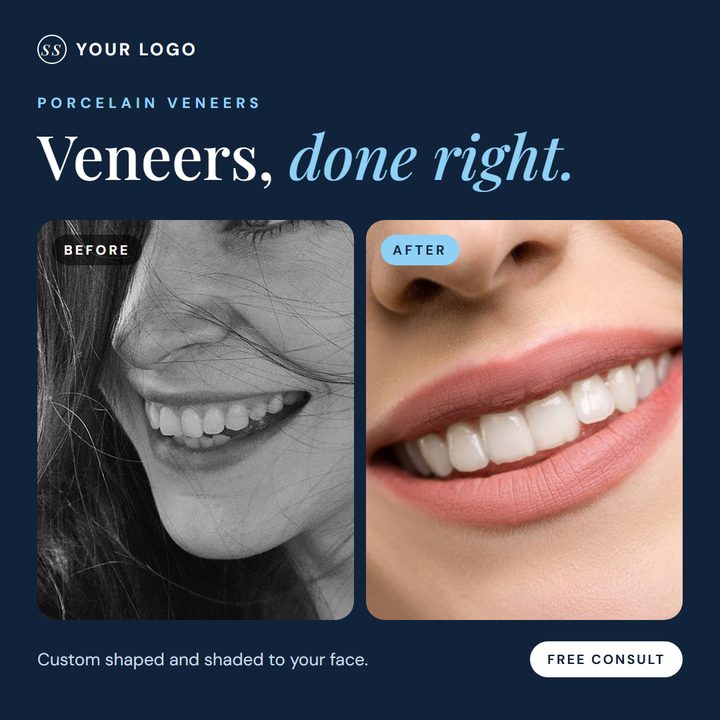 Sample Facebook post: Veneers